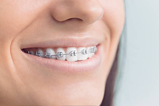 Dental Bonding in Holiday Heights, NJ